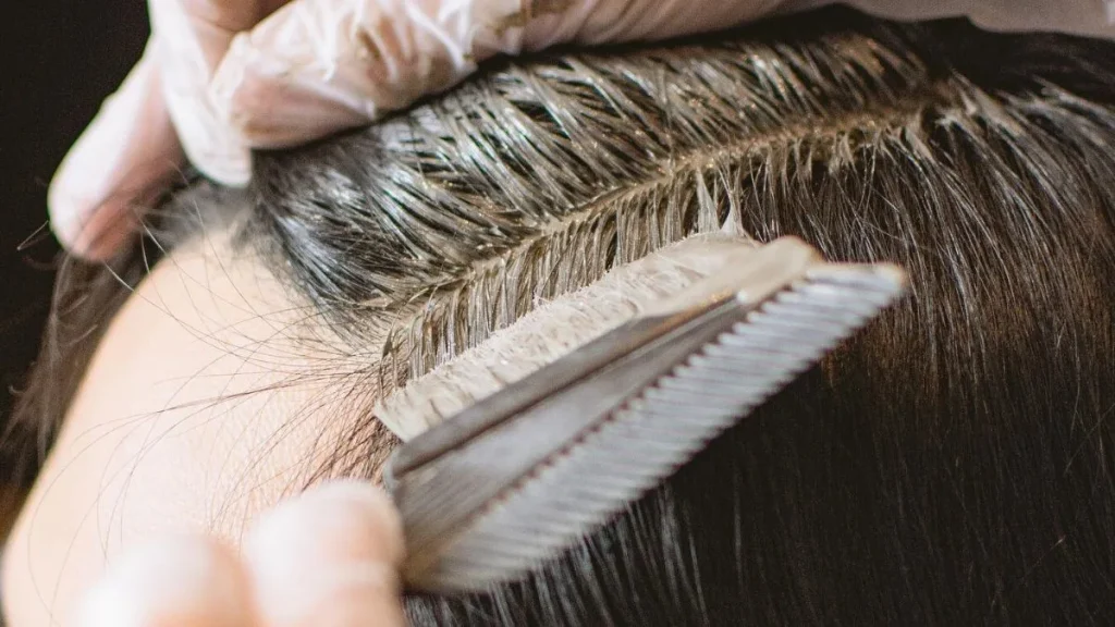 scalp consultation
